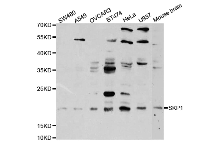 Anti-Skp1 p19 Antibody from Bioworld Technology (BS7223) - Antibodies.com