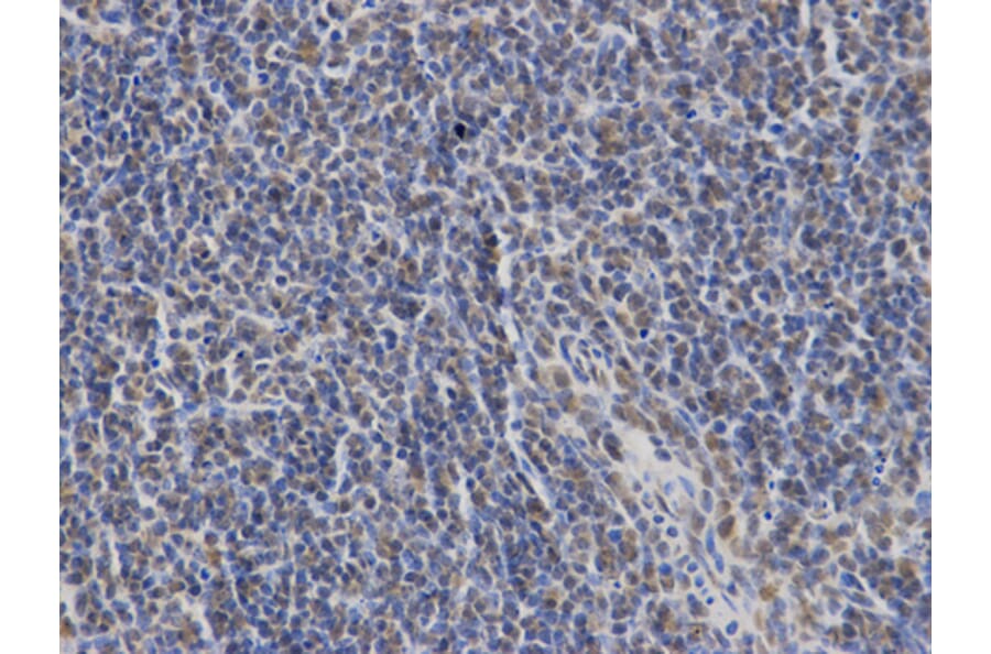 Anti-SLP-76 Antibody from Bioworld Technology (BS7224) - Antibodies.com