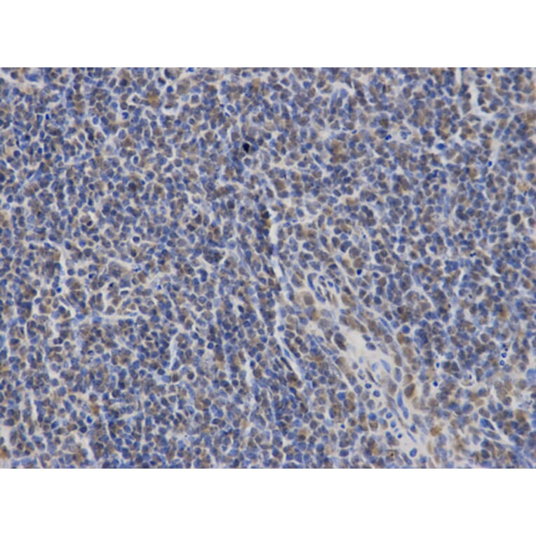 Anti-SLP-76 Antibody from Bioworld Technology (BS7224) - Antibodies.com