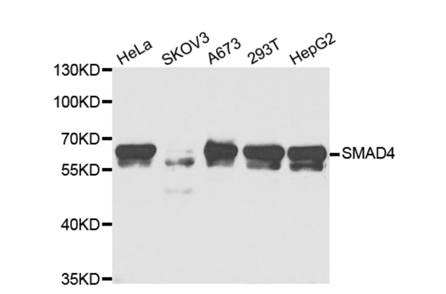 Anti-Smad4 Antibody from Bioworld Technology (BS7225) - Antibodies.com