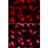 Anti-Smad4 Antibody from Bioworld Technology (BS7225) - Antibodies.com