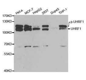 Anti-UHRF1 (ChIP Grade) Antibody from Bioworld Technology (BS7227) - Antibodies.com