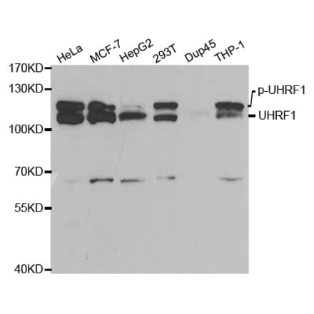 Anti-UHRF1 (ChIP Grade) Antibody from Bioworld Technology (BS7227) - Antibodies.com
