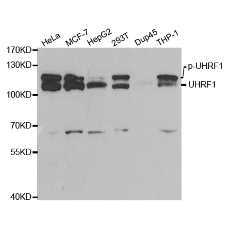 Anti-UHRF1 (ChIP Grade) Antibody from Bioworld Technology (BS7227) - Antibodies.com