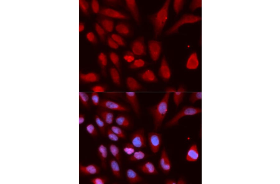 Anti-UHRF1 (ChIP Grade) Antibody from Bioworld Technology (BS7227) - Antibodies.com