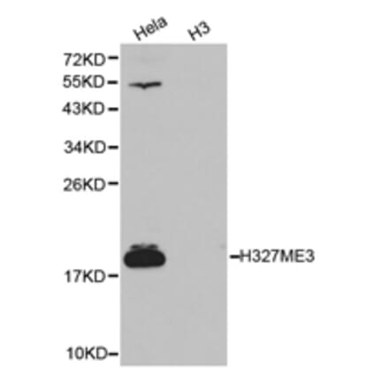Anti-Histone H3 (Tri-Methyl K27) Antibody from Bioworld Technology (BS7237) - Antibodies.com