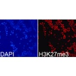 Anti-Histone H3 (Tri-Methyl K27) Antibody from Bioworld Technology (BS7237) - Antibodies.com