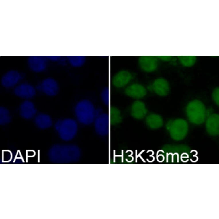 Anti-Histone H3 (Tri-Methyl K36) Antibody from Bioworld Technology (BS7239) - Antibodies.com