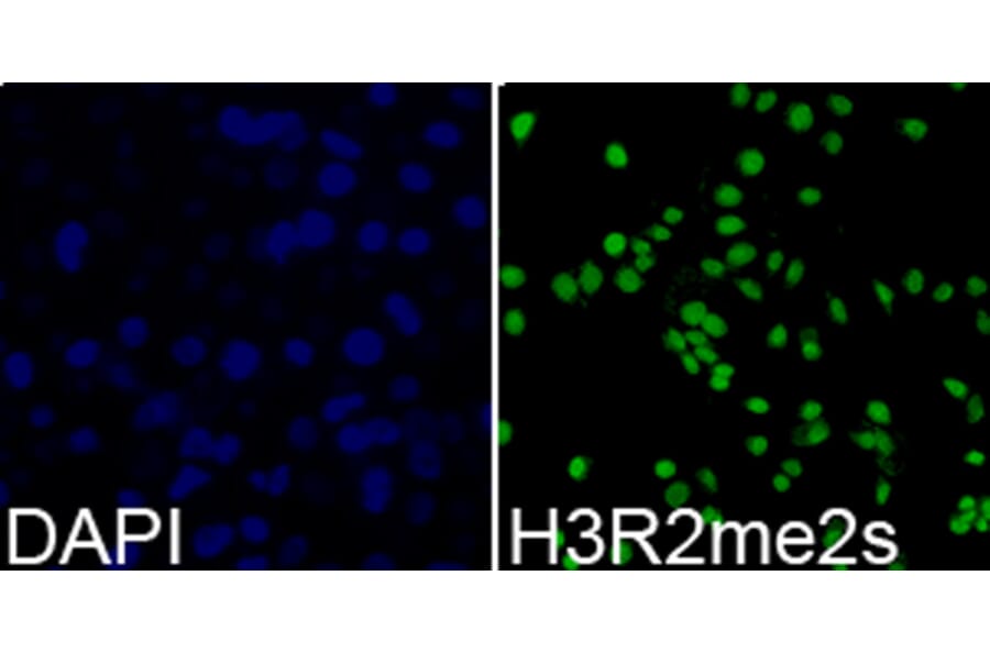 Anti-Histone H3 (sDi-Methyl R2) Antibody from Bioworld Technology (BS7243) - Antibodies.com