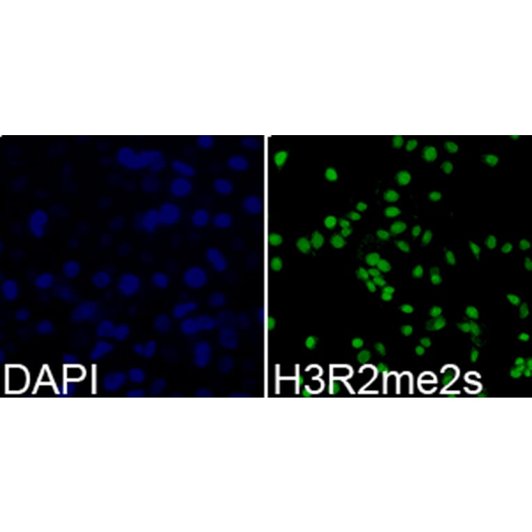 Anti-Histone H3 (sDi-Methyl R2) Antibody from Bioworld Technology (BS7243) - Antibodies.com