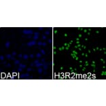 Anti-Histone H3 (sDi-Methyl R2) Antibody from Bioworld Technology (BS7243) - Antibodies.com