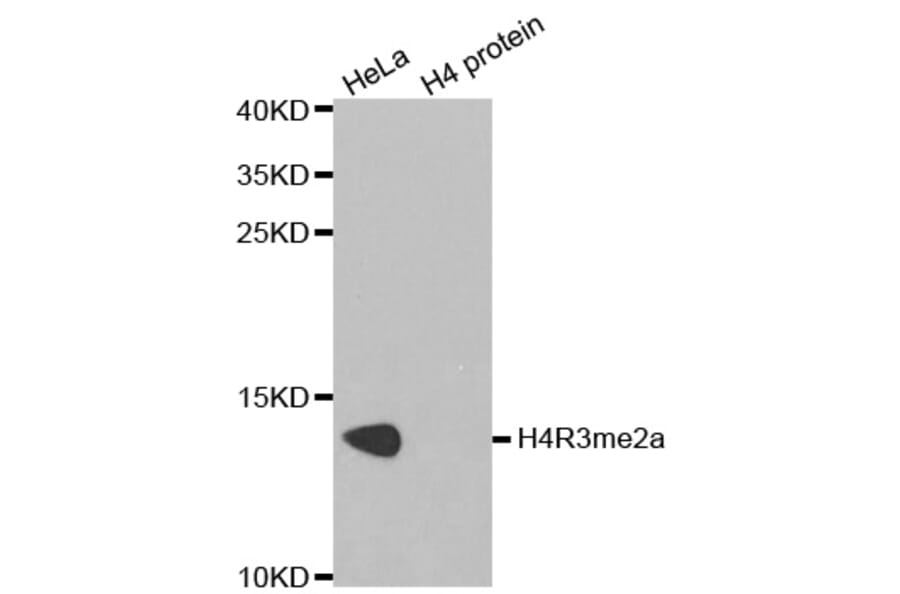 Anti-Histone H4 (aDi-Methyl R3) Antibody from Bioworld Technology (BS7246) - Antibodies.com