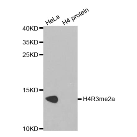 Anti-Histone H4 (aDi-Methyl R3) Antibody from Bioworld Technology (BS7246) - Antibodies.com