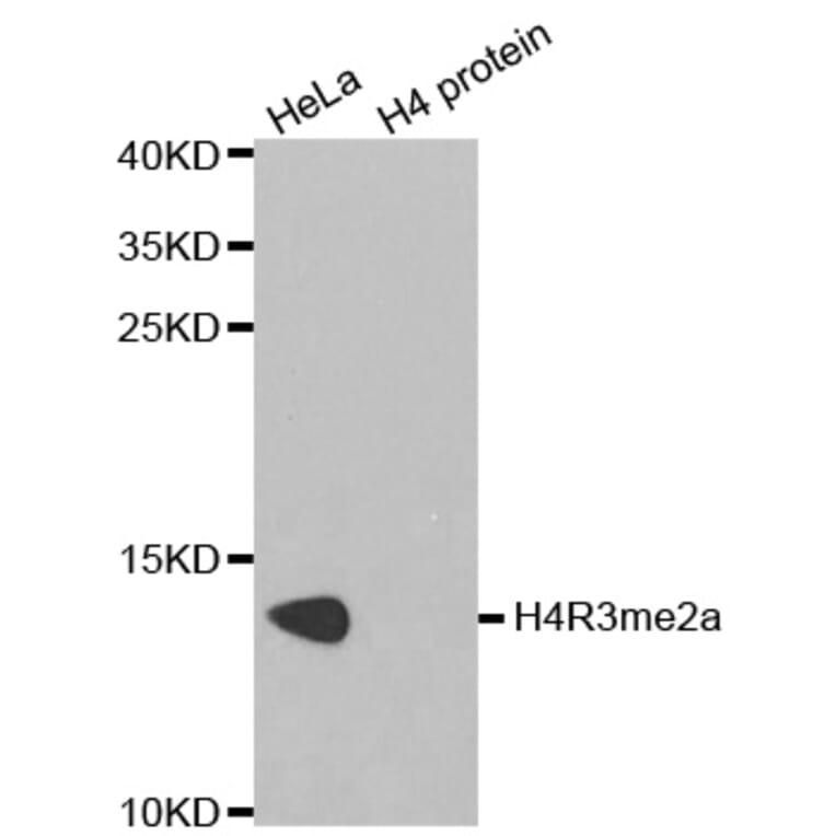 Anti-Histone H4 (aDi-Methyl R3) Antibody from Bioworld Technology (BS7246) - Antibodies.com