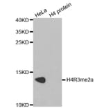 Anti-Histone H4 (aDi-Methyl R3) Antibody from Bioworld Technology (BS7246) - Antibodies.com