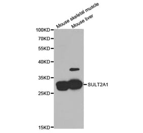 Anti-SULT2A1 Antibody from Bioworld Technology (BS7253) - Antibodies.com