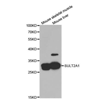 Anti-SULT2A1 Antibody from Bioworld Technology (BS7253) - Antibodies.com