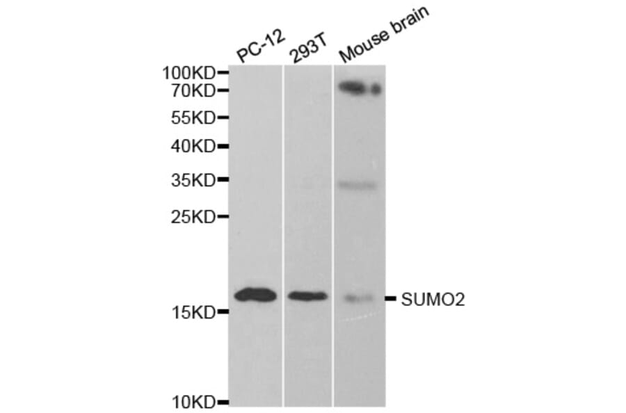 Anti-SUMO2 Antibody from Bioworld Technology (BS7254) - Antibodies.com
