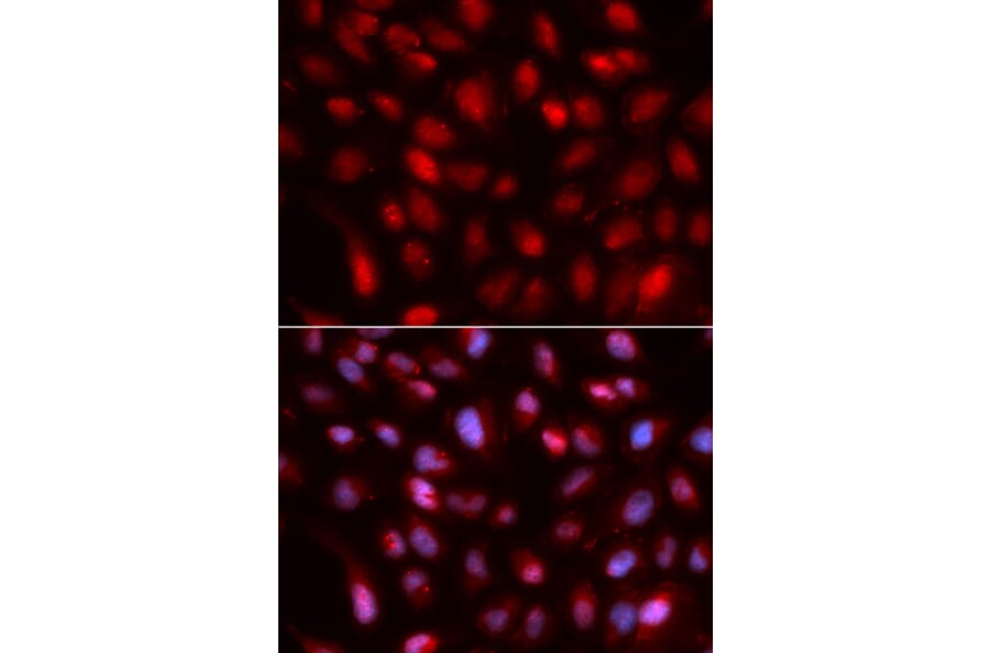 Anti-SUMO2 Antibody from Bioworld Technology (BS7254) - Antibodies.com