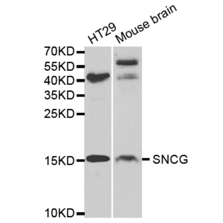 Anti-Synoretin Antibody from Bioworld Technology (BS7255) - Antibodies.com