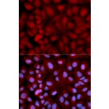 Anti-Synoretin Antibody from Bioworld Technology (BS7255) - Antibodies.com