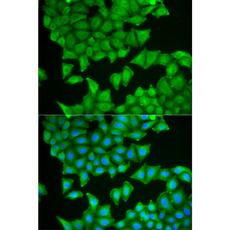 Anti-TEBP Antibody from Bioworld Technology (BS7259) - Antibodies.com