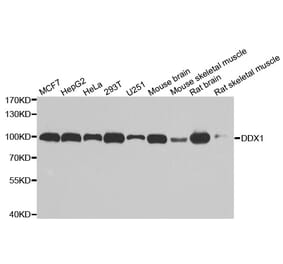 Anti-DDX1 Antibody from Bioworld Technology (BS7262) - Antibodies.com