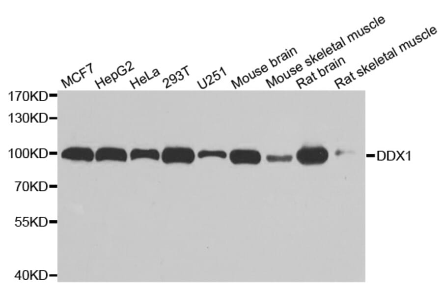 Anti-DDX1 Antibody from Bioworld Technology (BS7262) - Antibodies.com