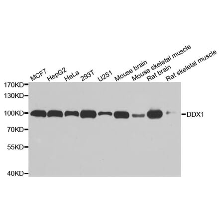 Anti-DDX1 Antibody from Bioworld Technology (BS7262) - Antibodies.com