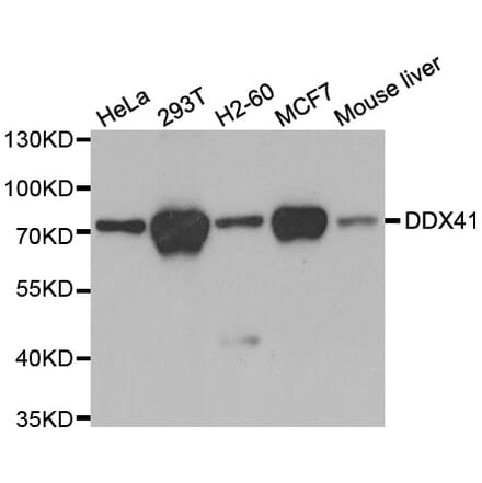 Anti-DDX41 Antibody from Bioworld Technology (BS7263) - Antibodies.com