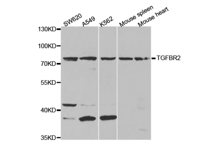 Anti-TGFβ RII Antibody from Bioworld Technology (BS7266) - Antibodies.com