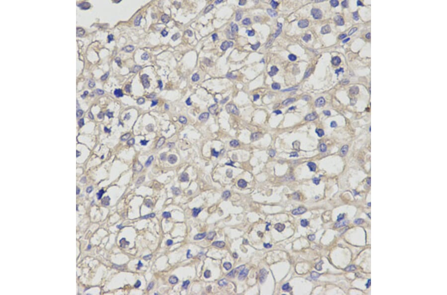Anti-TGFβ RII Antibody from Bioworld Technology (BS7266) - Antibodies.com
