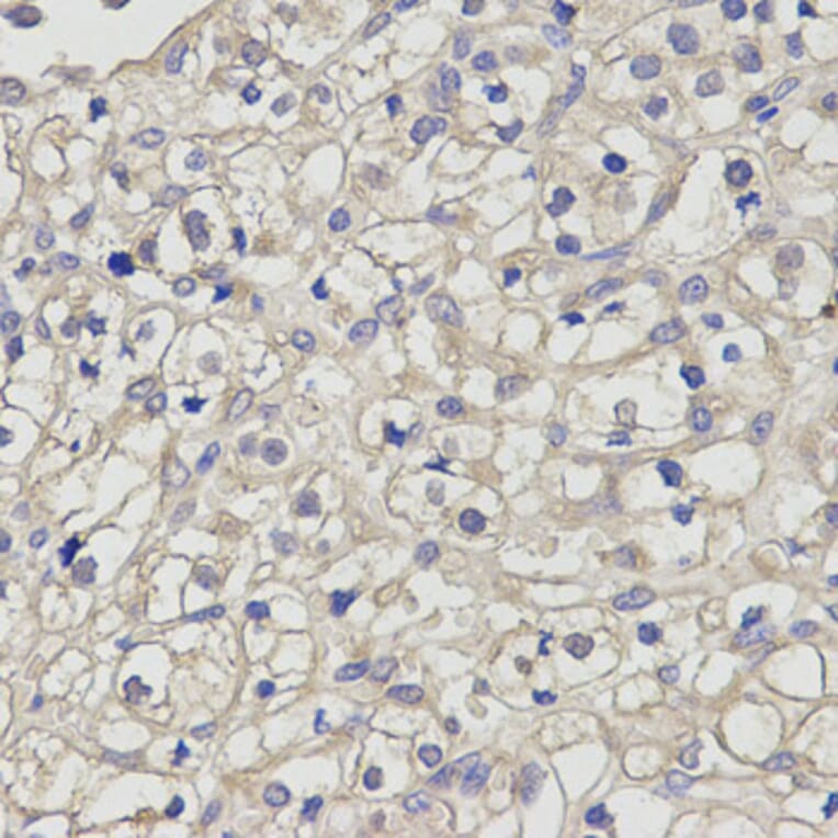 Anti-TGFβ RII Antibody from Bioworld Technology (BS7266) - Antibodies.com