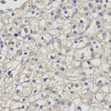 Anti-TGFβ RII Antibody from Bioworld Technology (BS7266) - Antibodies.com