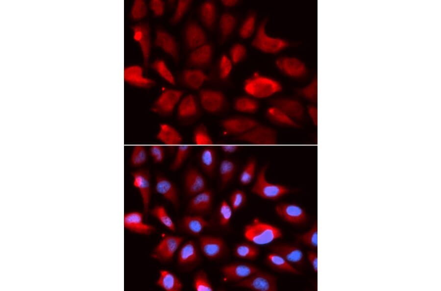 Anti-TGFβ RII Antibody from Bioworld Technology (BS7266) - Antibodies.com