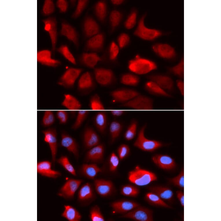 Anti-TGFβ RII Antibody from Bioworld Technology (BS7266) - Antibodies.com