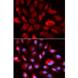 Anti-TGFβ RII Antibody from Bioworld Technology (BS7266) - Antibodies.com