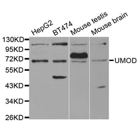 Anti-THP Antibody from Bioworld Technology (BS7267) - Antibodies.com