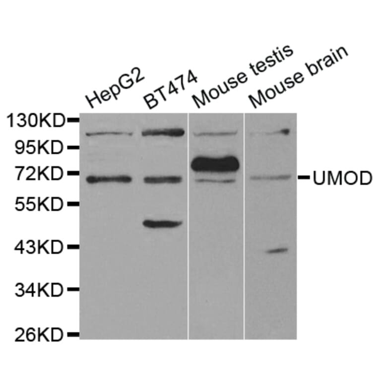 Anti-THP Antibody from Bioworld Technology (BS7267) - Antibodies.com