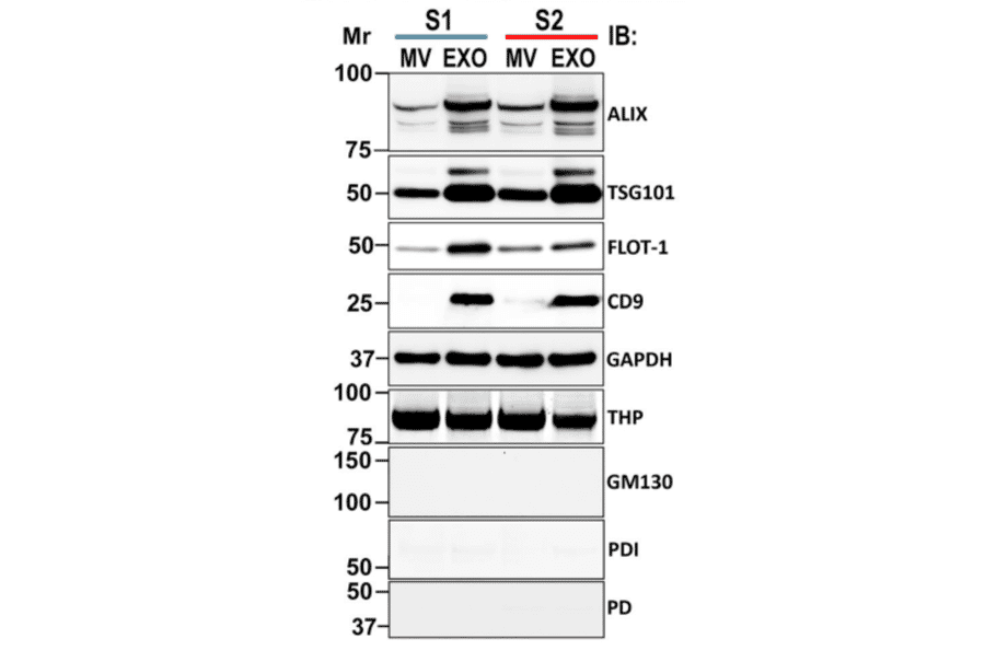 Western Blot - Anti-THP Antibody - Antibodies.com
