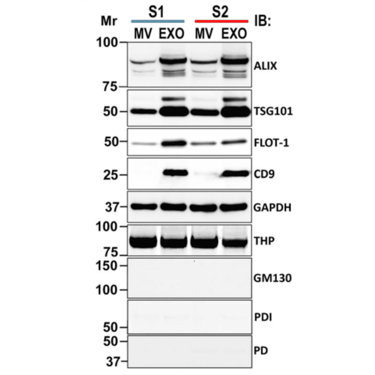 Western Blot - Anti-THP Antibody - Antibodies.com