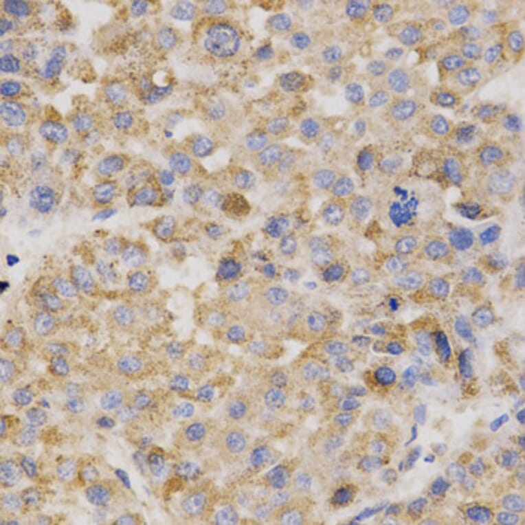 Anti-Thrombopoietin Antibody from Bioworld Technology (BS7268) - Antibodies.com