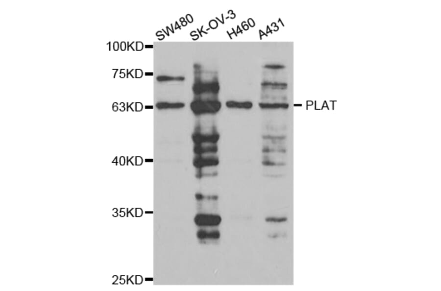 Anti-tPA Antibody from Bioworld Technology (BS7270) - Antibodies.com