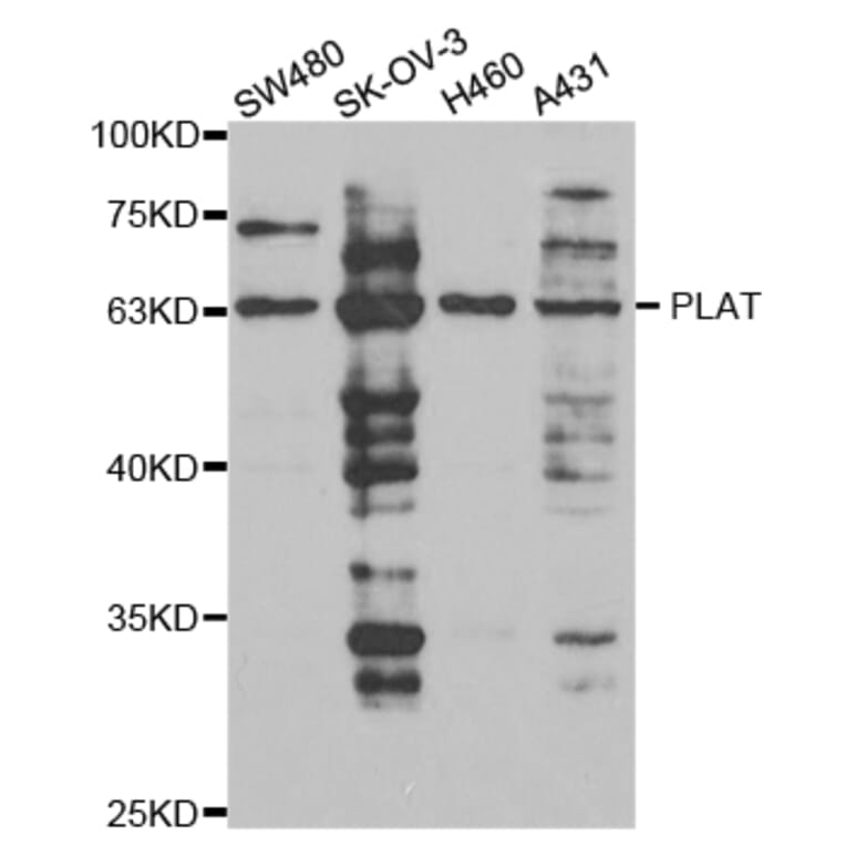 Anti-tPA Antibody from Bioworld Technology (BS7270) - Antibodies.com