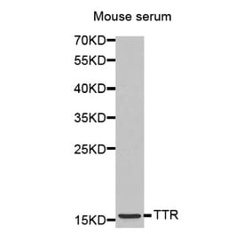 Anti-TTR Antibody from Bioworld Technology (BS7273) - Antibodies.com