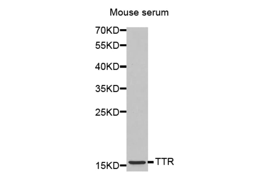 Anti-TTR Antibody from Bioworld Technology (BS7273) - Antibodies.com