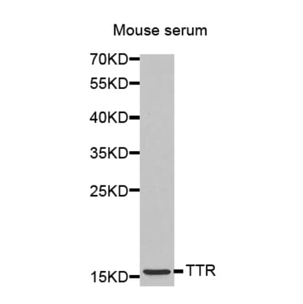 Anti-TTR Antibody from Bioworld Technology (BS7273) - Antibodies.com