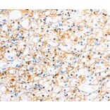 Anti-TTR Antibody from Bioworld Technology (BS7273) - Antibodies.com
