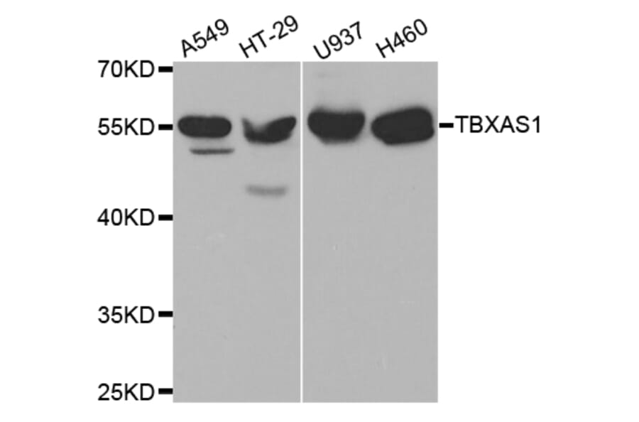 Anti-TXA synthase Antibody from Bioworld Technology (BS7276) - Antibodies.com