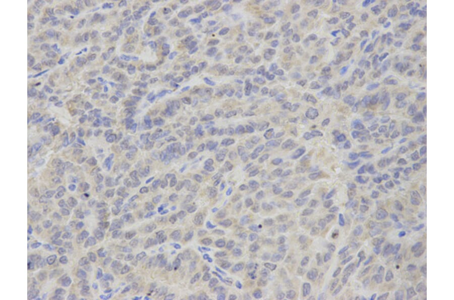 Anti-TXA synthase Antibody from Bioworld Technology (BS7276) - Antibodies.com